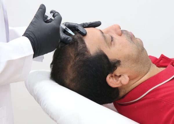 Mesoterapia facial, capilar y corporal